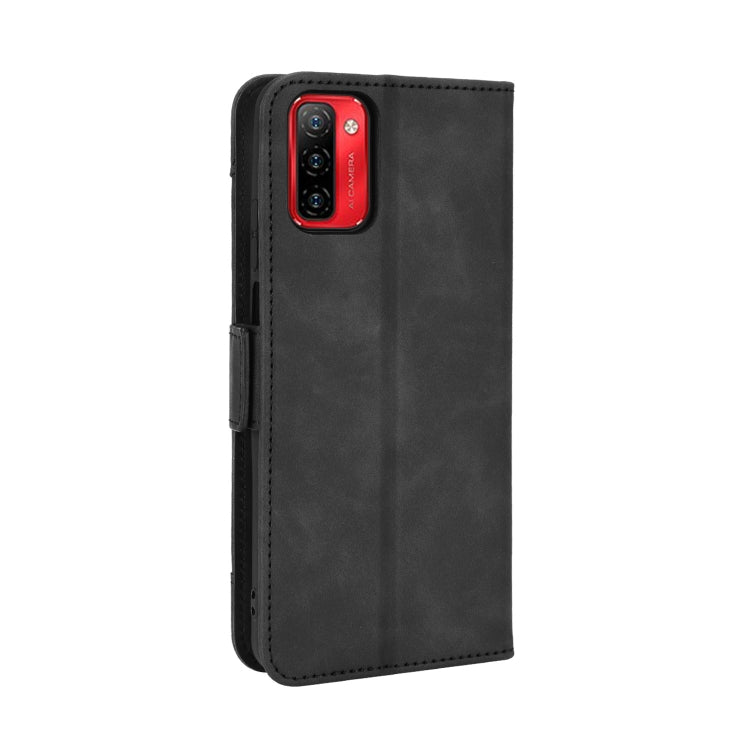 For Ulefone Note 12P Skin Feel Calf Pattern Leather Phone Case(Black) - Ulefone Cases by PMC Jewellery | Online Shopping South Africa | PMC Jewellery | Buy Now Pay Later Mobicred