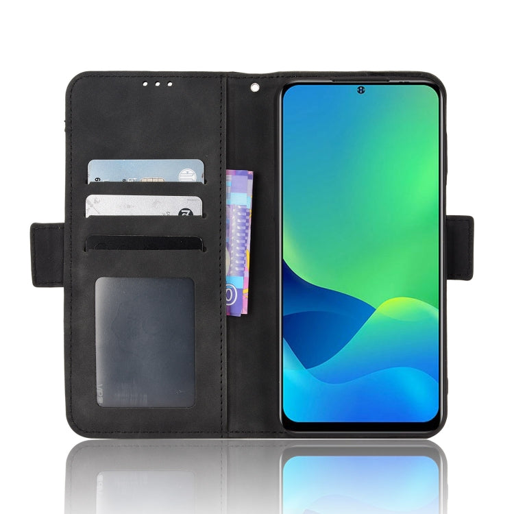 For Ulefone Note 13P Skin Feel Calf Pattern Leather Phone Case(Black) - Ulefone Cases by PMC Jewellery | Online Shopping South Africa | PMC Jewellery | Buy Now Pay Later Mobicred