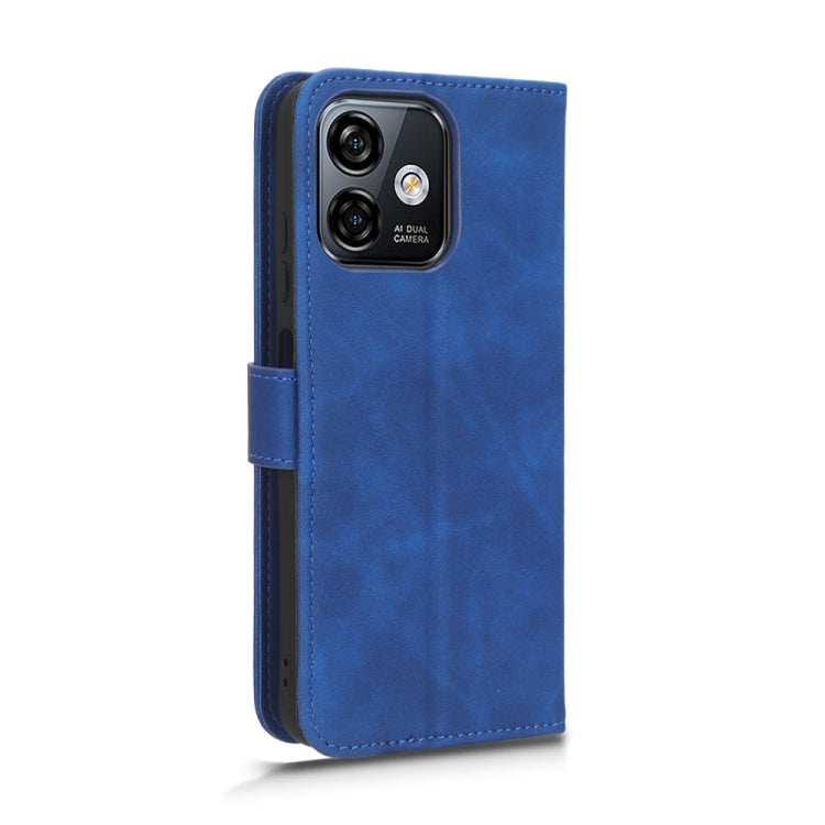 For Ulefone Note 16 Pro Skin Feel Magnetic Flip Leather Phone Case(Blue) - Ulefone Cases by PMC Jewellery | Online Shopping South Africa | PMC Jewellery | Buy Now Pay Later Mobicred