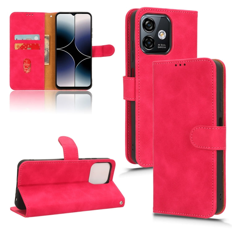 For Ulefone Note 16 Pro Skin Feel Magnetic Flip Leather Phone Case(Rose Red) - Ulefone Cases by PMC Jewellery | Online Shopping South Africa | PMC Jewellery | Buy Now Pay Later Mobicred