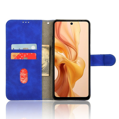 For Ulefone Note 18 Ultra Skin Feel Magnetic Flip Leather Phone Case(Blue) - Ulefone Cases by PMC Jewellery | Online Shopping South Africa | PMC Jewellery | Buy Now Pay Later Mobicred