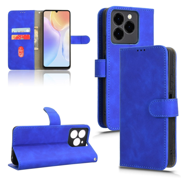 For Ulefone Note 20 Pro Skin Feel Magnetic Flip Leather Phone Case(Blue) - Ulefone Cases by PMC Jewellery | Online Shopping South Africa | PMC Jewellery | Buy Now Pay Later Mobicred